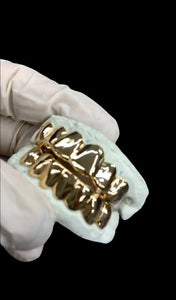 gold grillz