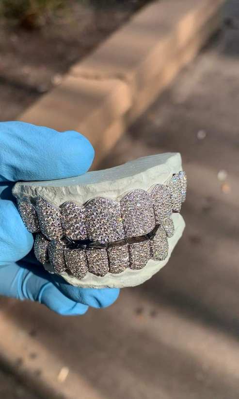 diamond grillz